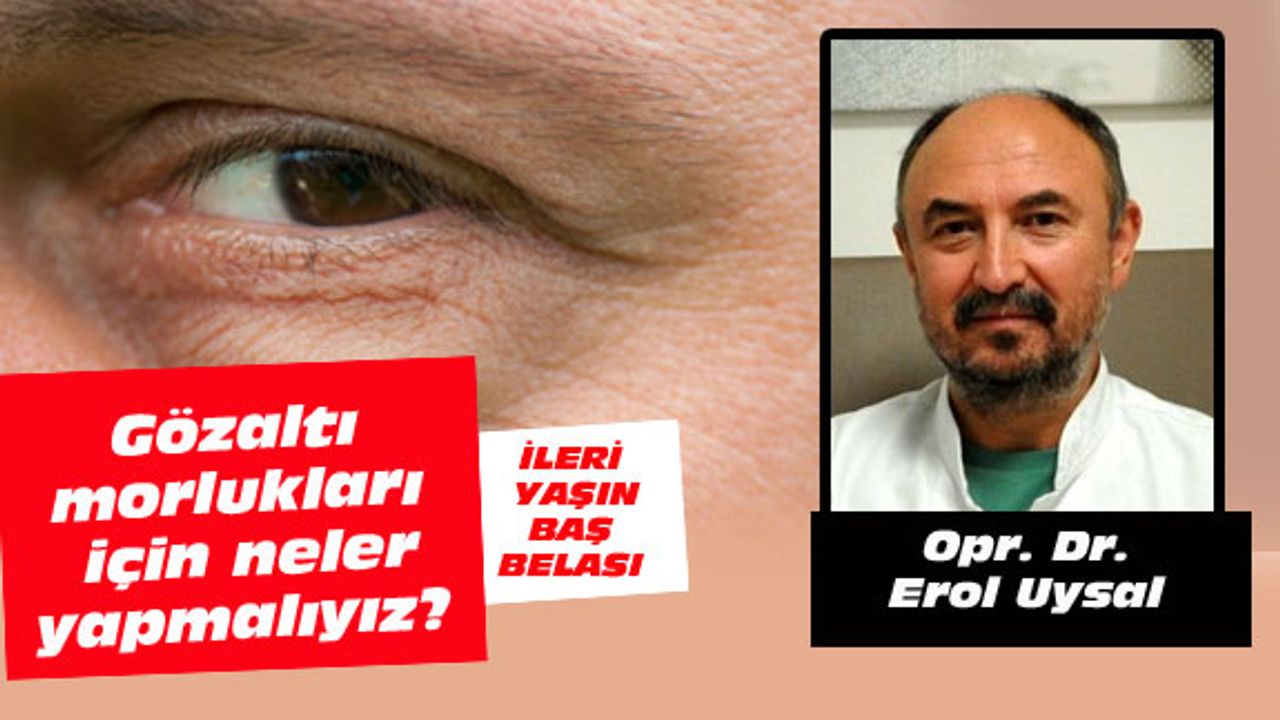 Gözaltı morlukları için neler yapmalıyız?
