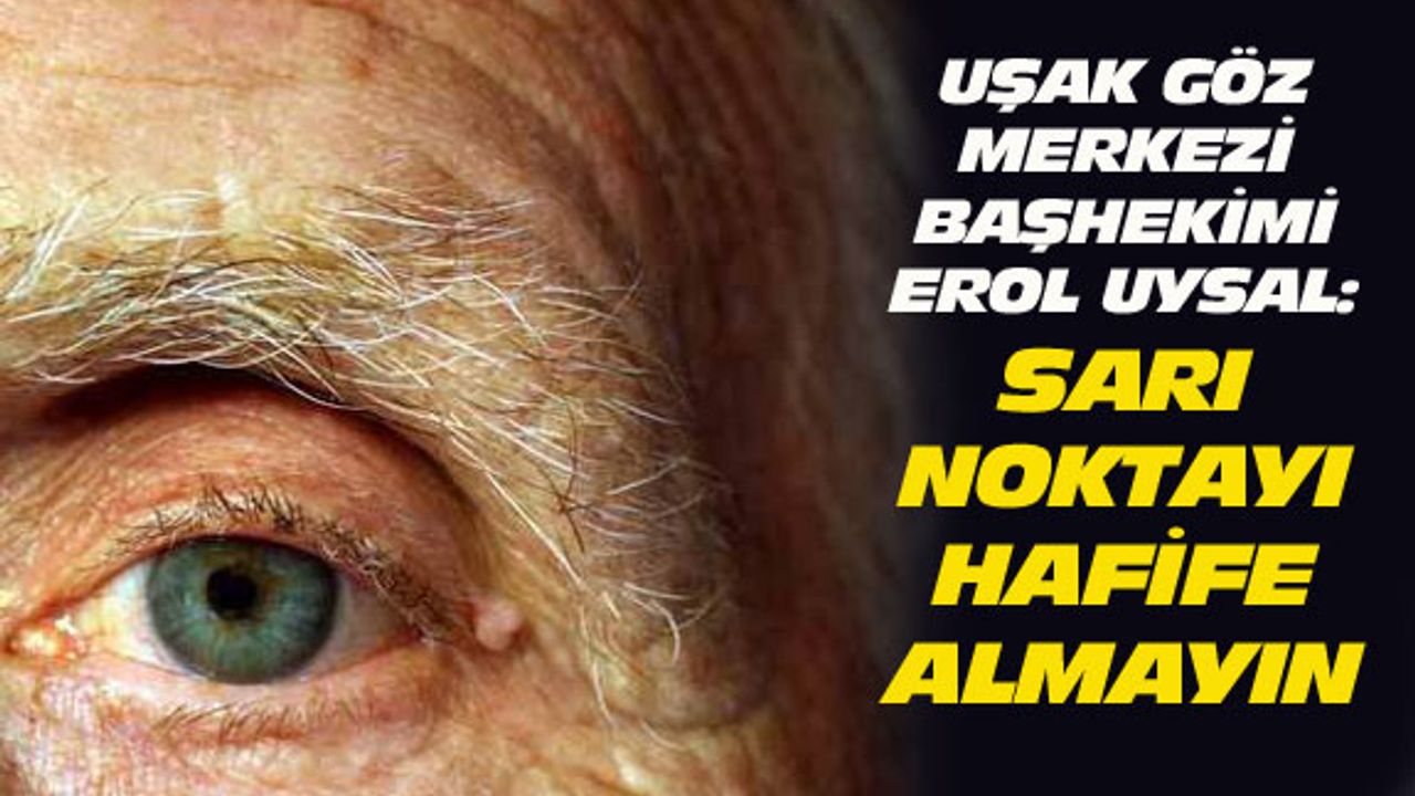 Sarı nokta hastalığını hafife almayın