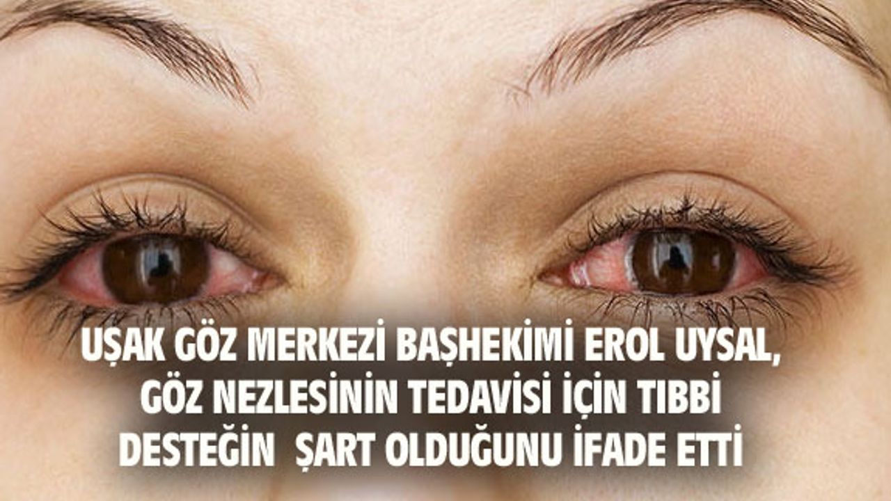 Erol Uysal, göz nezlesine karşı uyarıyor