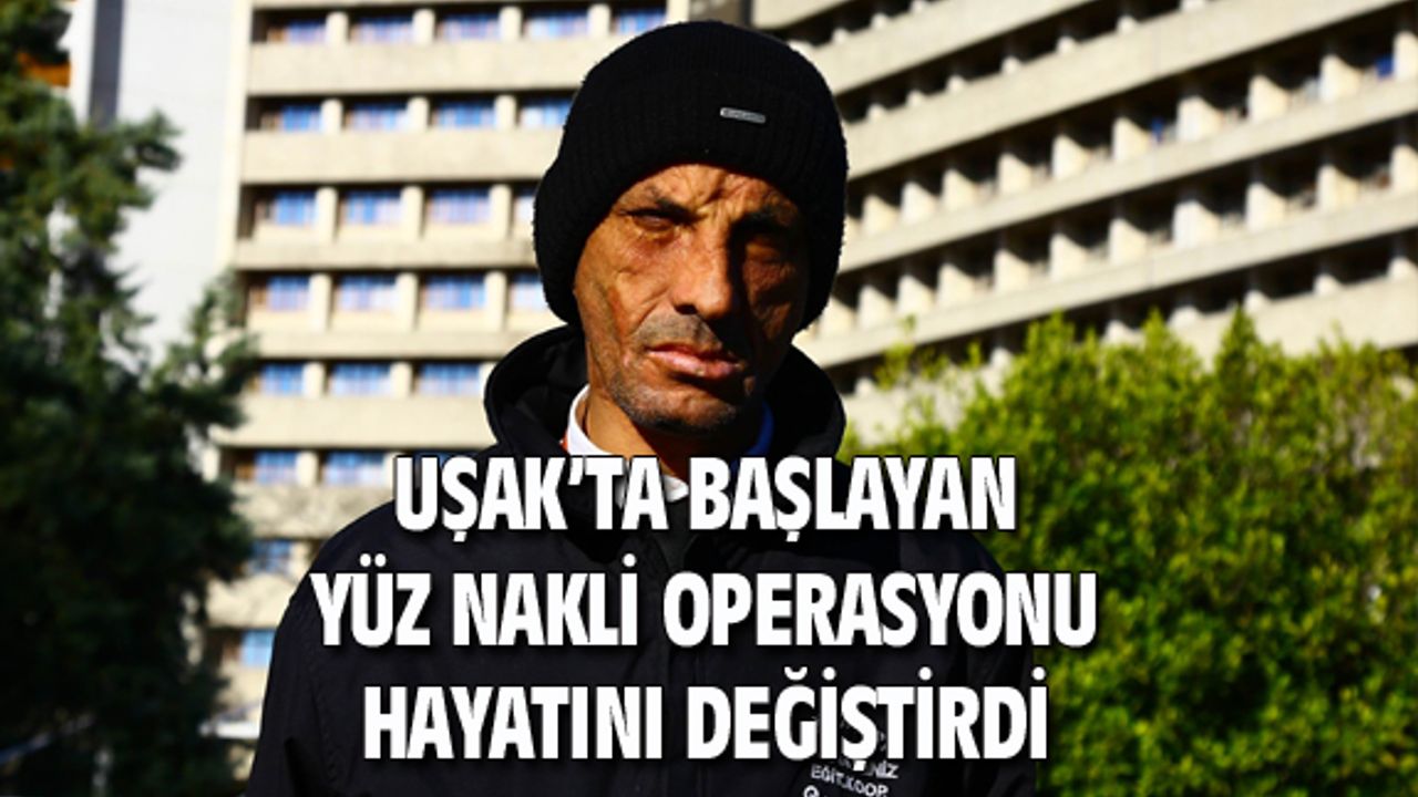 Uşak'ta başlayan yüz nakli operasyonu hayatını değiştirdi