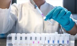 1 Aralık Dünya AIDS Günü nedir?