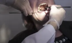 Obezitenin etkilediği alanlardan biri de diş tedavisi