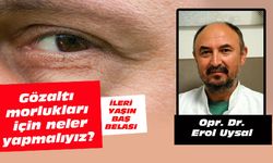 Gözaltı morlukları için neler yapmalıyız?