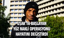Uşak'ta başlayan yüz nakli operasyonu hayatını değiştirdi