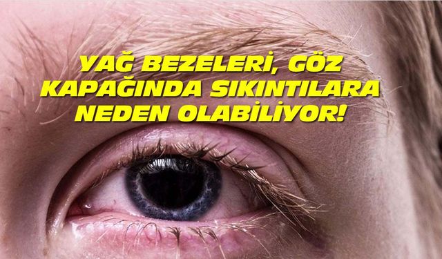 Yağ bezeleri göz kapağında rahatsızlıklara yol açabilir!