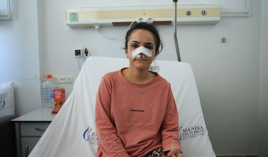 Turgutlu Yıldırım Mahallesi'nde yaşayan ve burnu eşi tarafından koparıldığı öne sürülen kadın olayı anlattı